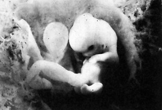 6──受胎36日の胎児 引用出典＝三木成夫『胎児の世界──人類の生命記憶』（中公新書、1983）